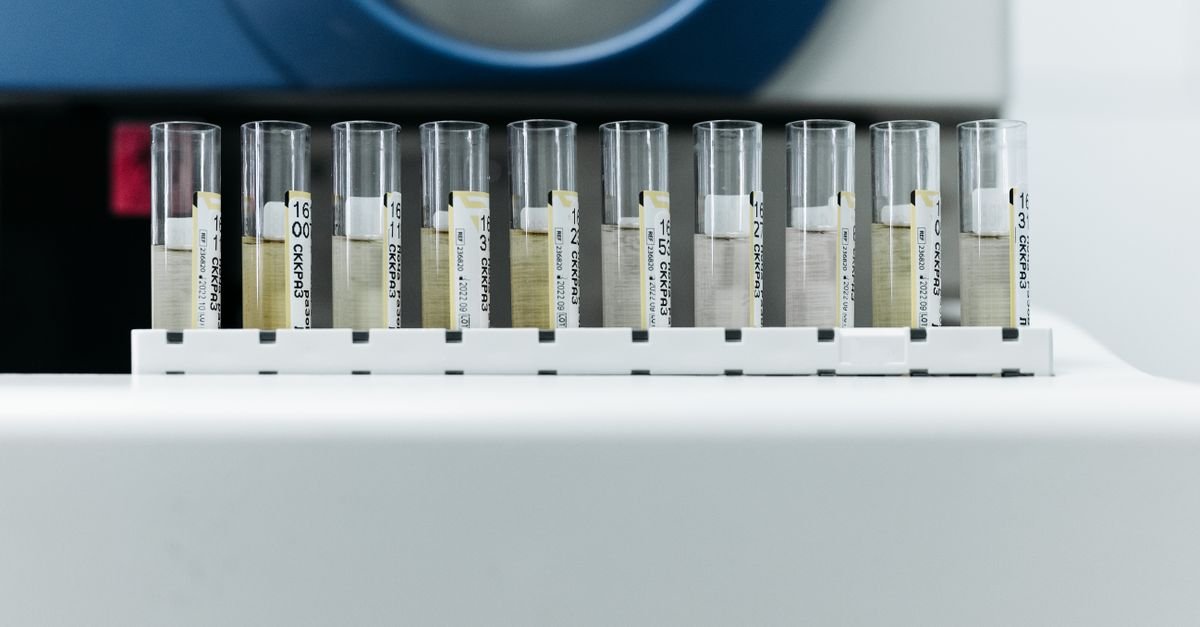 Walnut Shell Biocarbon Shows Promise for High-Performance Supercapacitors