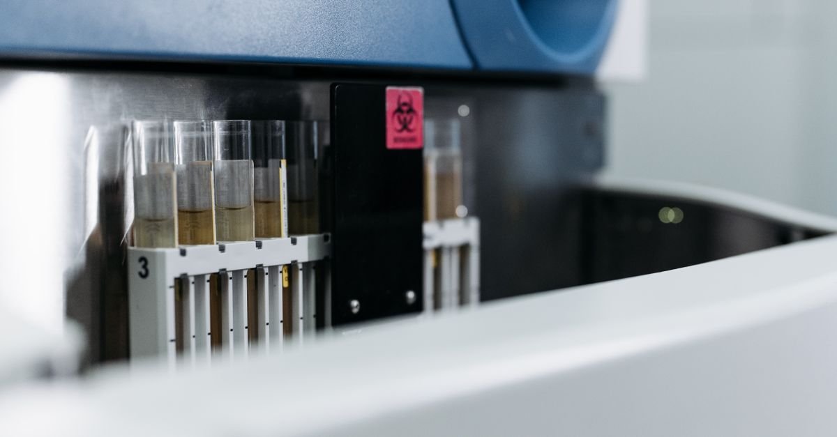 AI Model Improves Fast Charging Safety for Lithium-Ion Batteries